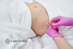 Are The Results From Aqualyx Permanent? 1 Do you want to know how long Aqualyx Sleaford results last?