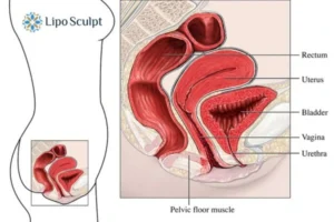Treatment For A Leaky Bladder 2 How EM Chair treatment Sleaford can help Leaky bladder issues. Read more now!