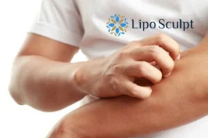Best Actinic Keratoses Removal 4 prevent your actinic keratoses Sleaford getting worse - call our team today!