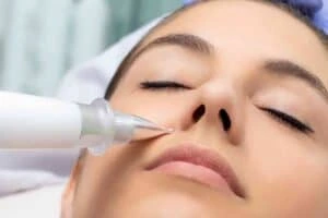 Best Actinic Keratoses Removal 3 Actinic keratoses Sleaford solutions - book in today!