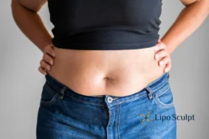 Bidding Farewell to Muffin Tops with Aqualyx Fat Injections 2 Do you wish you could reduce your muffin top Sleaford With Aqualy fat dissolving injections you can!