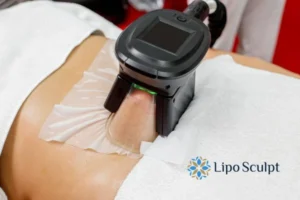 Does Fat Freezing At Home Work? 3 Fat freezing at home from Lipo Sculpt Sleaford
